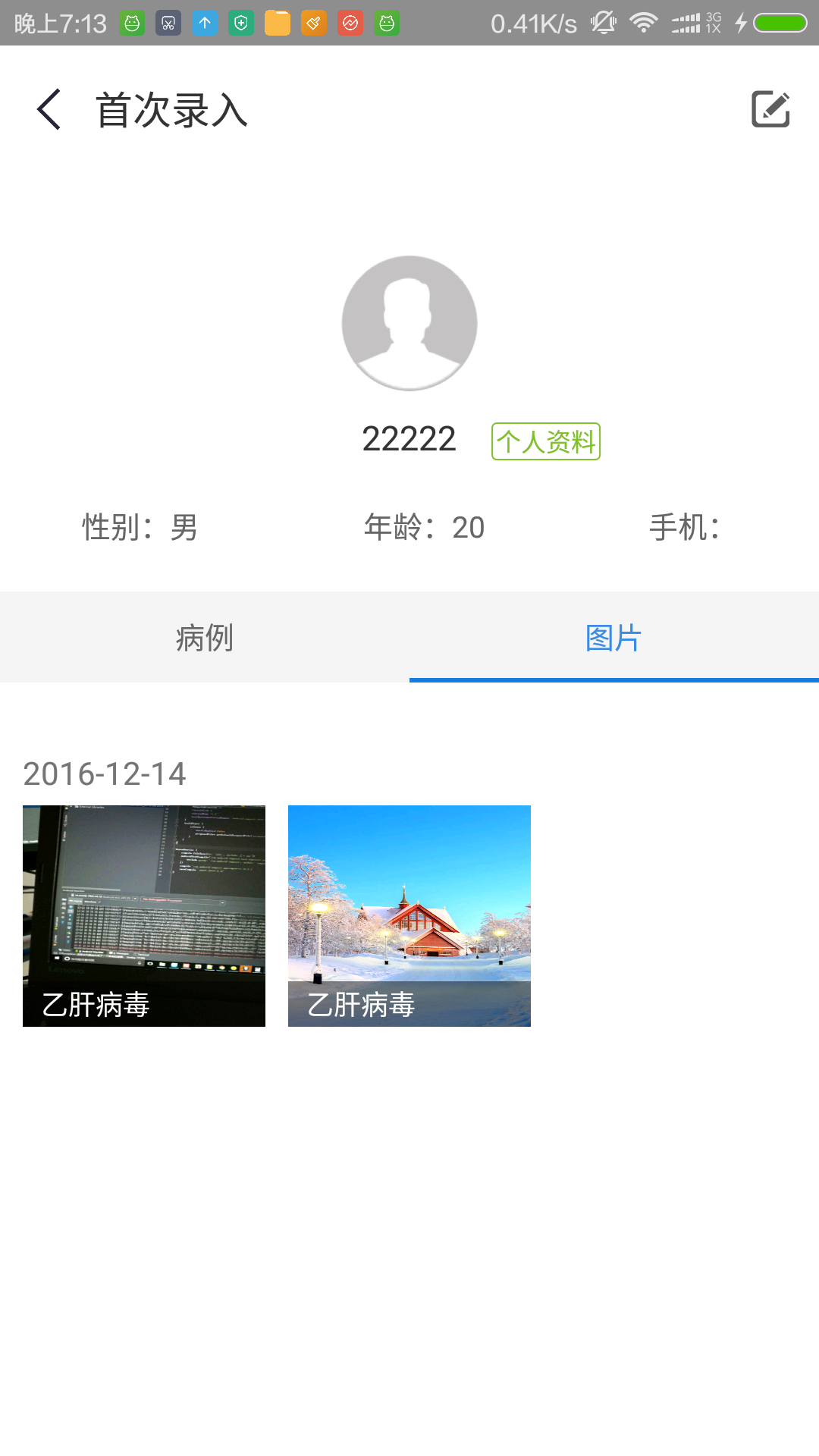 CR-HepB